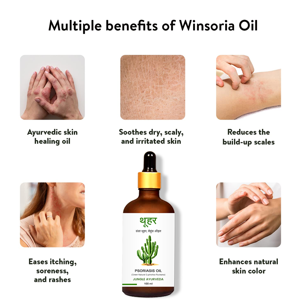 Danda Thuhar Herbal Oil for skin and Psoriasis, Danda Thor Oil, Euphorbia royleana Oil, Sehund Ayurvedic Tailam to manage Psoriasis & Eczema