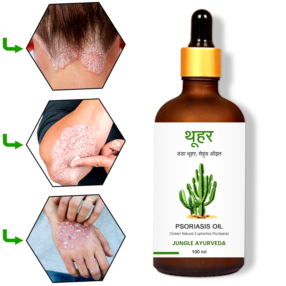 Danda Thuhar Herbal Oil for skin and Psoriasis, Danda Thor Oil, Euphorbia royleana Oil, Sehund Ayurvedic Tailam to manage Psoriasis & Eczema