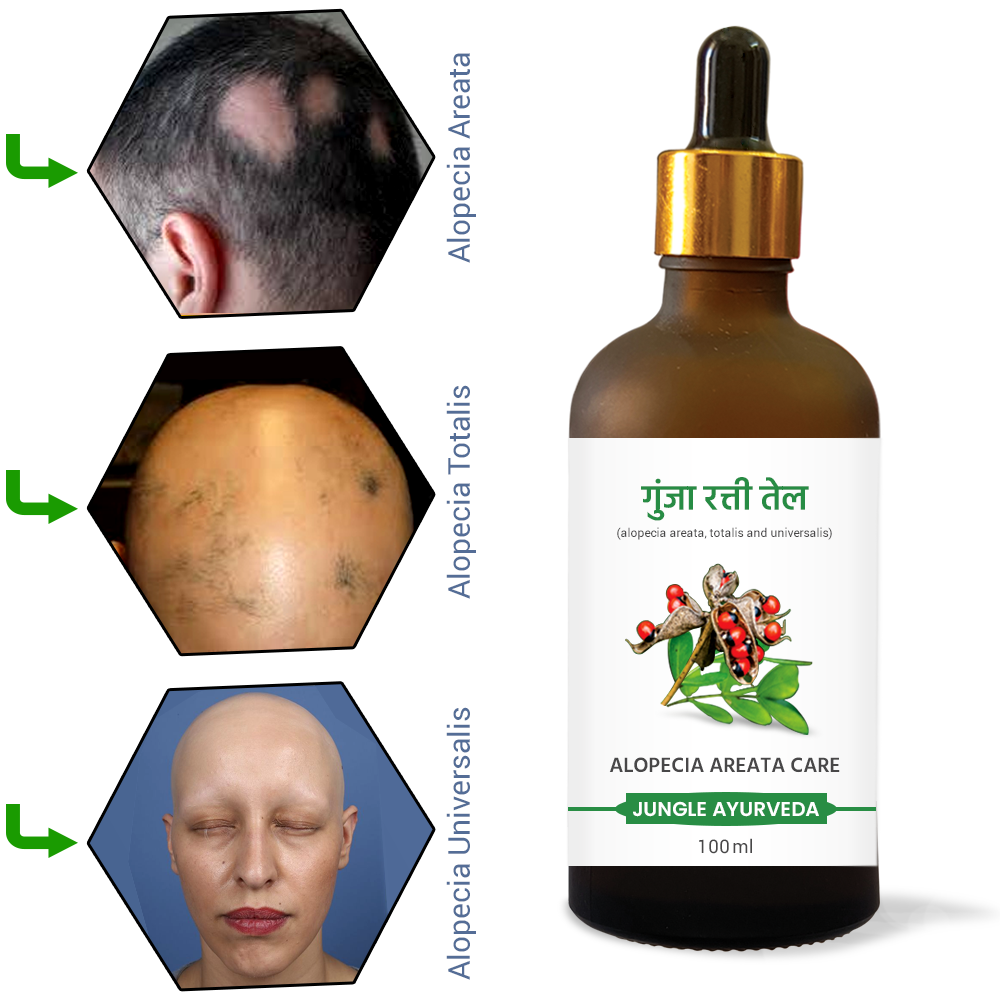 Gunja Ratti Hair Oil, Hair Growth Oil, Hairfall & Breakage Control, Hair & Scalp Therapy, Anti-Fungal Beard Oil, Helps in Alopecia Areata & Beard Growth