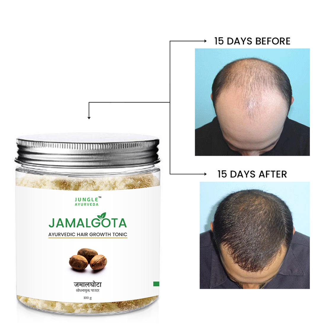 Jamalgota Powder for Hair regrowth and alopecia treatment